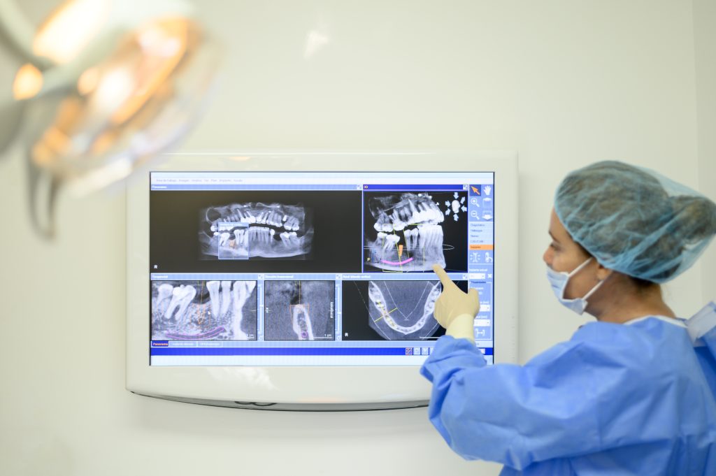 Planning based on dental CT scan