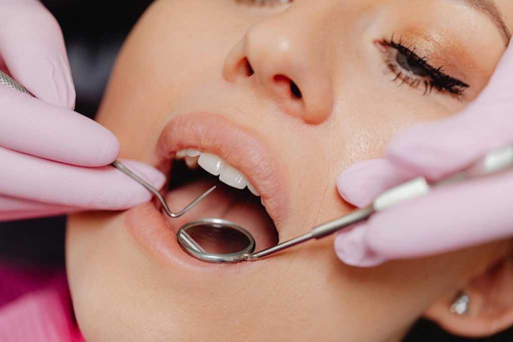 A dental check-up is recommended prior to bleaching