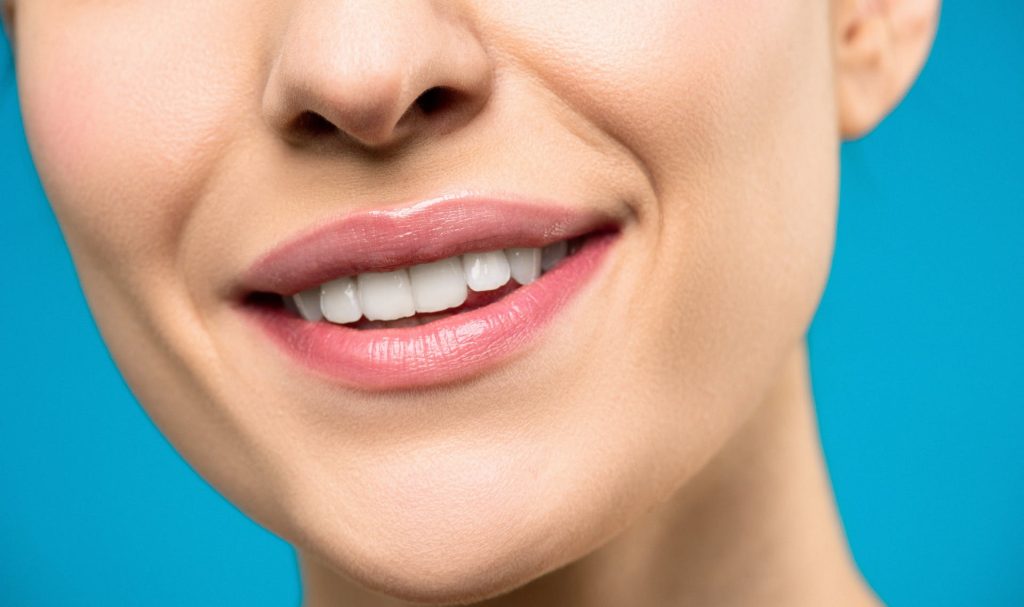 Snow-white teeth after the in-office procedure