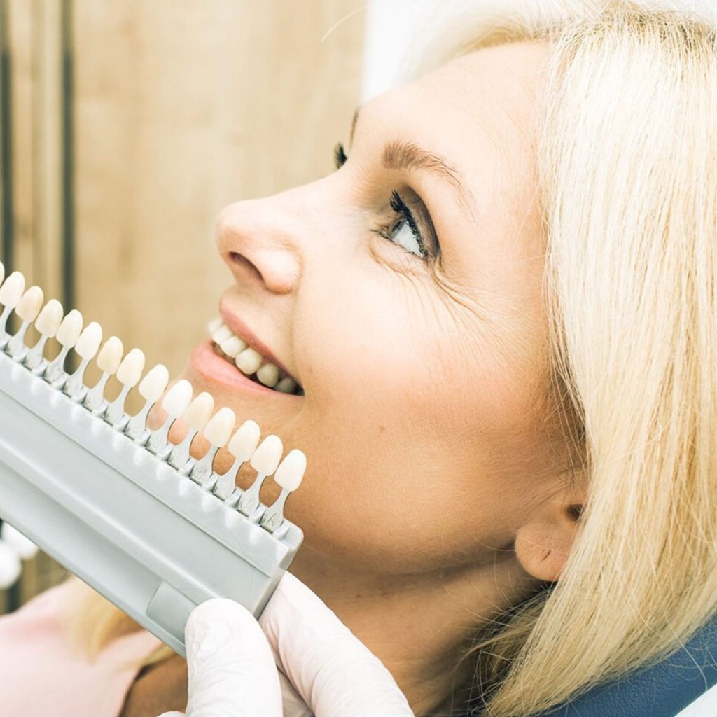 Checking the tooth color so that the restoration will look natural